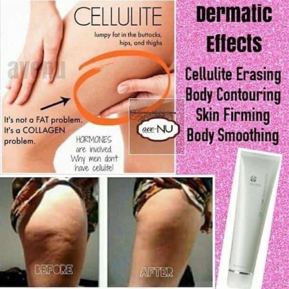 Cellulite cream aka dramatic effects